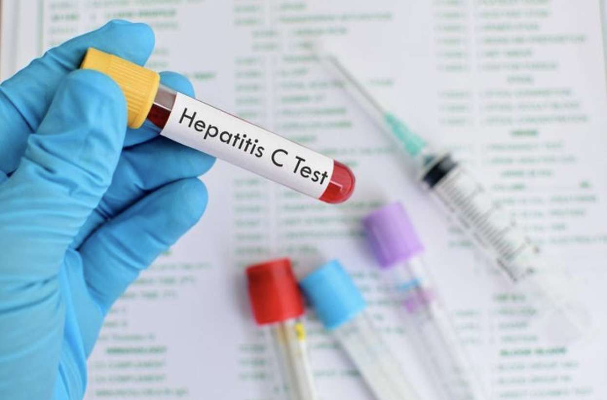  Hep C Urgent Care Walk-In Clinic NYC